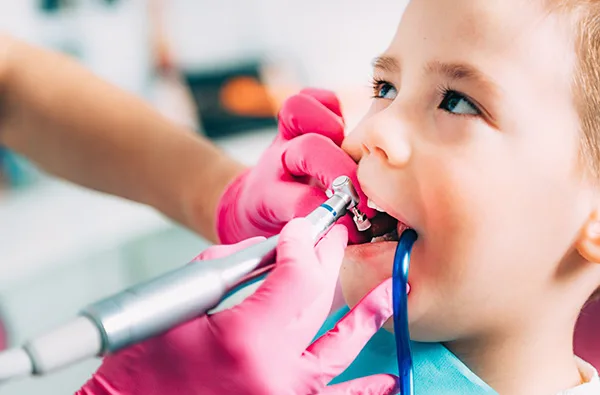 Odontopediatría en OMI Dental
